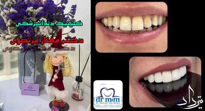 نوبت دهی دندانپزشکی دکتر مهناز مرتضوی