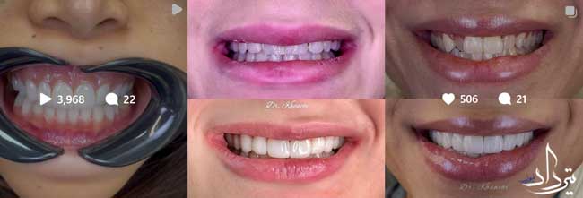 دکتر سحر خانچی دندانپزشک زیبایی