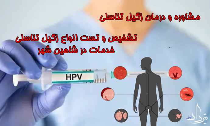 انواع خدمات درمان زگیل تناسلی شاهین شهر