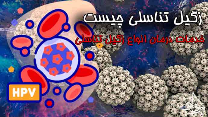 درمان زگیل تناسلی آق قلا کلینیک درمان زگیل تناسلی آق قلا