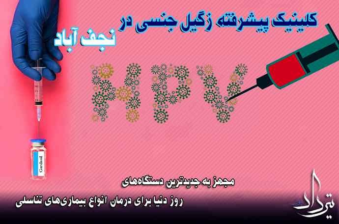 درمان زگیل تناسلی نجف آباد کلینیک درمان زگیل تناسلی منطقه نجف آباد