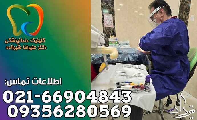 مطب دندانپزشکی کلاهدوز انتخابی برای دندان های سالم