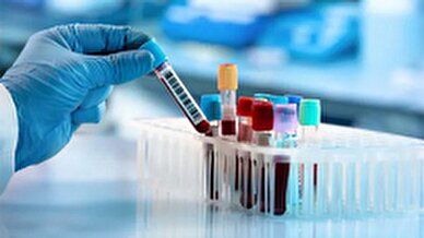 پردازش دقیق و سریع نمونه های آزمایشگاهی با فناوری بومی